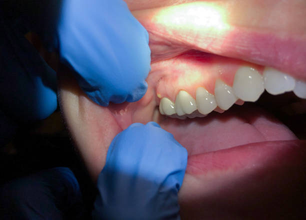 Professional Emergency Dental Service in MO