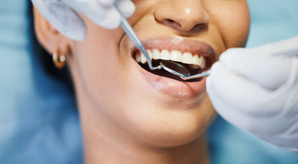 Best Dental Abscess Treatment in Maryville, MO